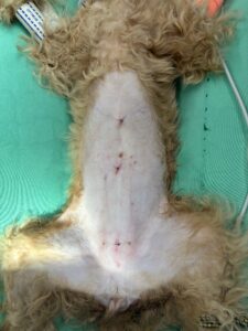 腹腔鏡手術の術創