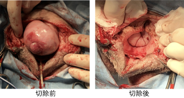 膣腫瘍